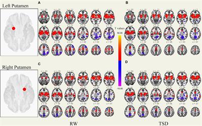 Altered Functional Connectivity in the Resting State Neostriatum After Complete Sleep Deprivation: Impairment of Motor Control and Regulatory Network